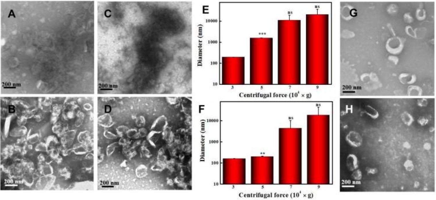 TEM images of cucumber-derived nanovesicles isolated by different centrifugation speeds.